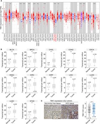 TANK-Binding Kinase 1 (TBK1) Serves as a Potential Target for Hepatocellular Carcinoma by Enhancing Tumor Immune Infiltration